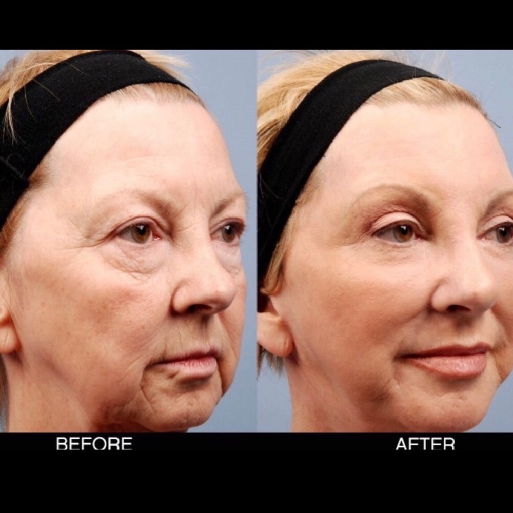 DAY AND NIGHT AGE RECOVERY CREAM SERUMS BOTH 2 OZ